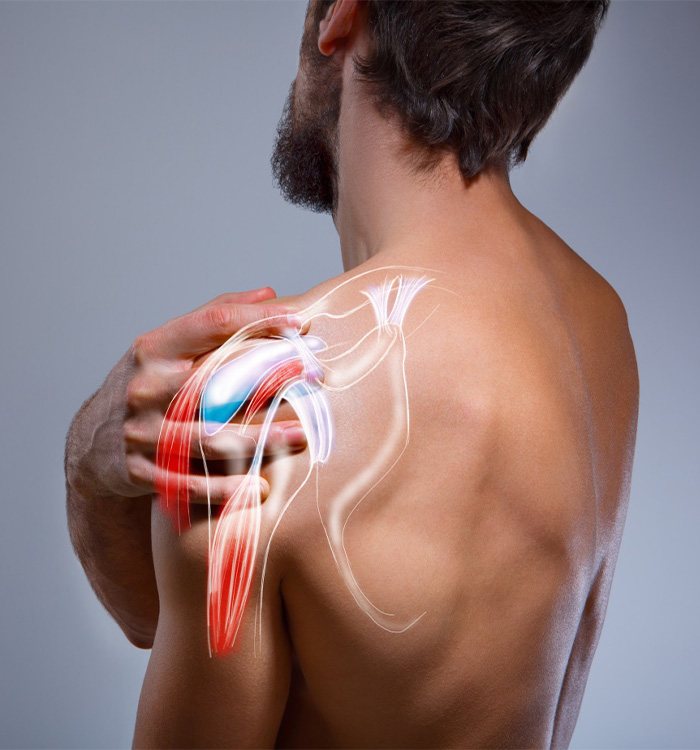 Man suffering from shoulder pain