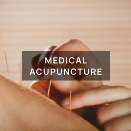 Patient receiving medical acupuncture