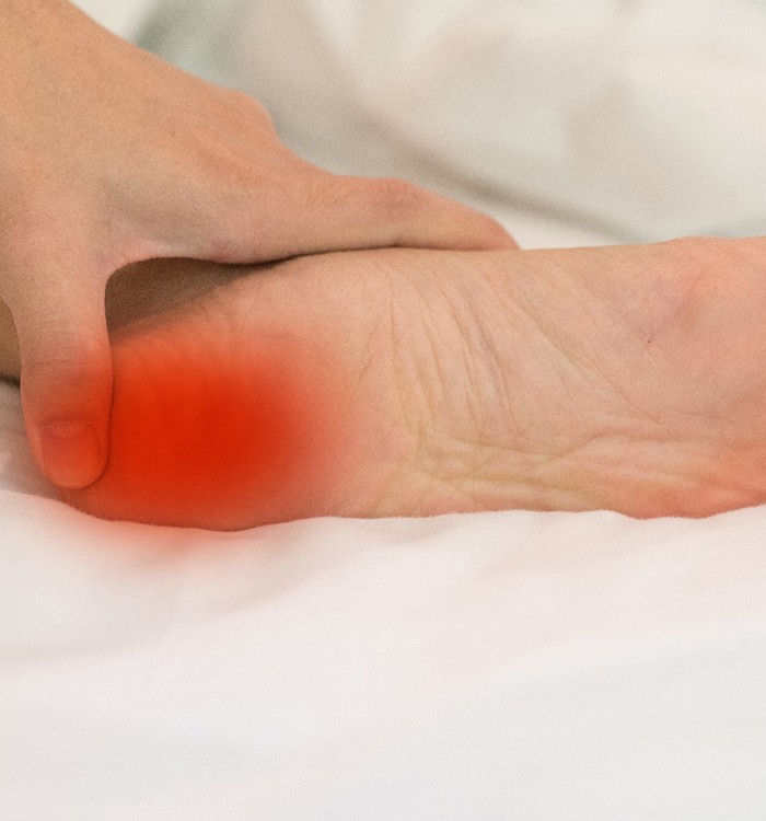 person bracing foot in bed with plantar fasciitis 