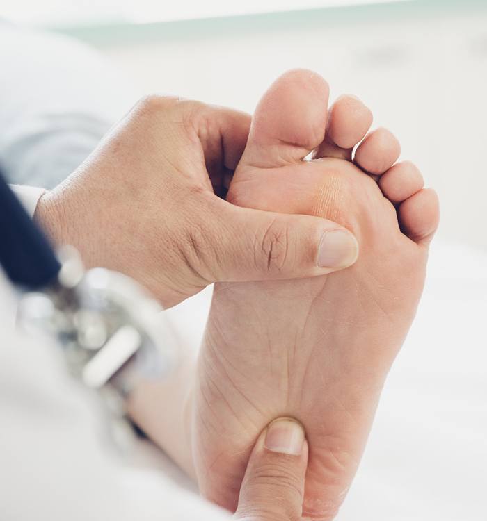 doctor examining patient with plantar fasciitis 