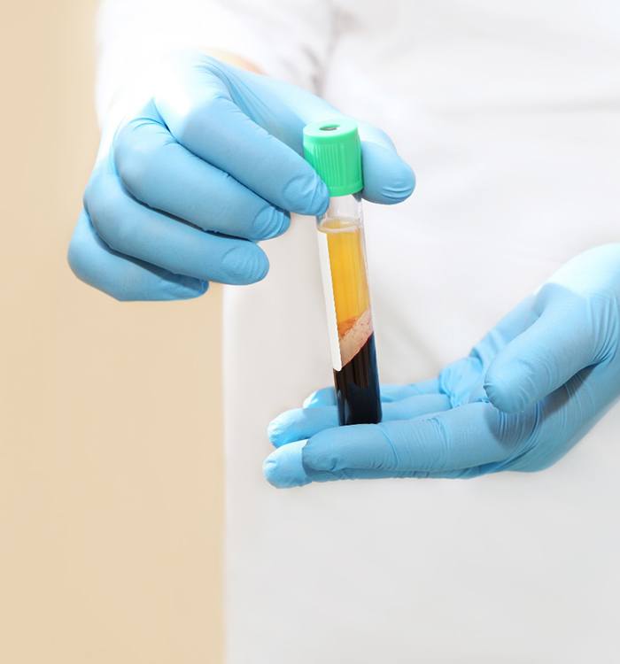Holding a bottle of plasma for PRP therapy in Asheville