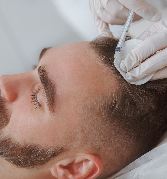 Man receiving a PRP injection in his forehead