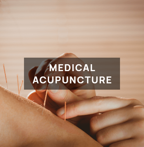 Medical acupuncture