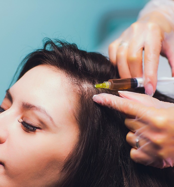 woman receiving Vampire Hair Restoration 