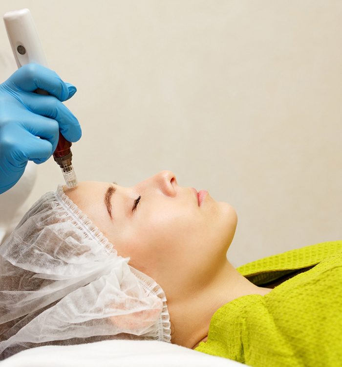 woman receiving microneedling 