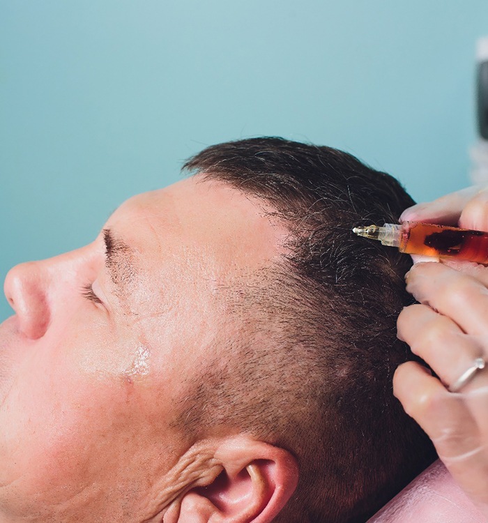 man receiving PRP hair restoration 