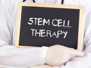 Doctor holding “stem cell therapy” sign